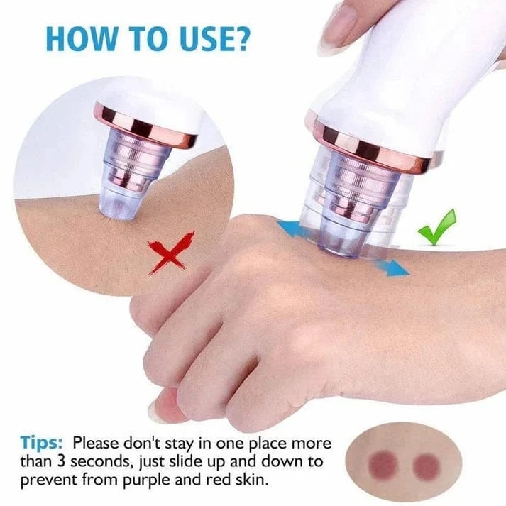 Powerful Blackhead Removal Machine – Skin Care & Pore Cleaner