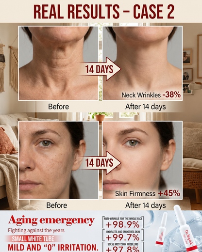 Dr.Mopiok Anti-Wrinkle Essence Firming & Anti-Aging Facial Serum with Collagen Hyaluronic Acid for Smooth Skin